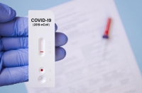 Гърция слага таван на цените на тестовете за коронавирус