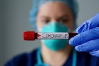 3858 теста за коронавирусна инфекция са направени до момента в Бургас 
