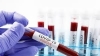 Словакия въвежда строги мерки срещу коронавируса
