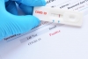 Русия отчита най-малък брой нови случаи на коронавирус за денонощие от края на април 