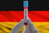 Нови 340 случая на коронавирус за денонощието в Германия 