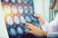 Невролози ще преглеждат безплатно пациенти с установена болест на Паркинсон 