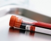 Тестват БЦЖ ваксината срещу коронавируса  